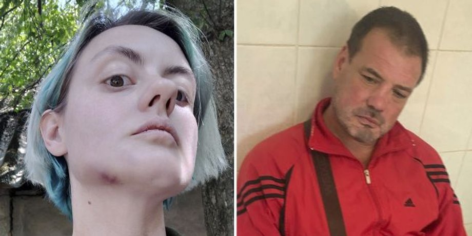 новости закарпатья, новости Ужгорода, военкомат, избиение, военнослужащий, военкомат