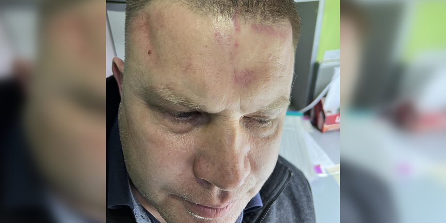 Мэр Белгород-Днестровского Виталий Граждан