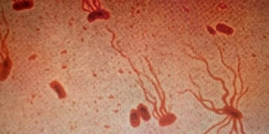 Salmonella enterica serovar Typhi