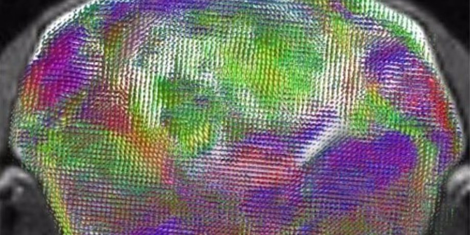 мозг мыши