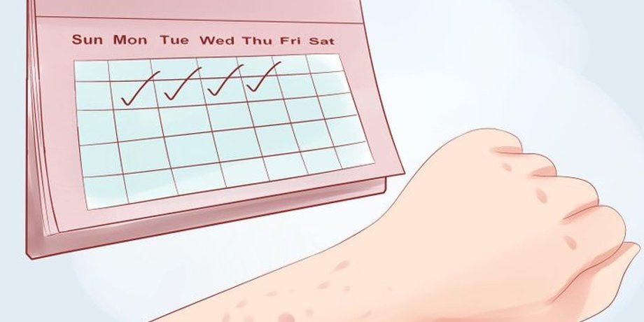 Фото:wikiHow