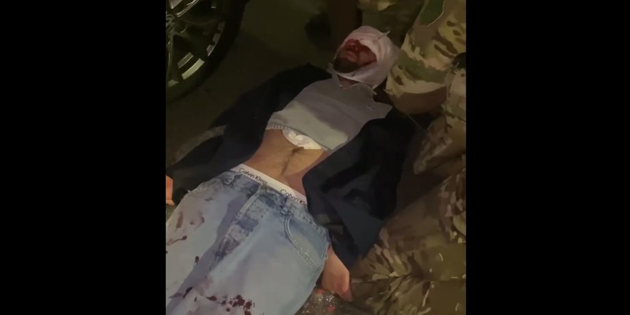 дтп с зеленским, видео дтп с участием авто зеленского