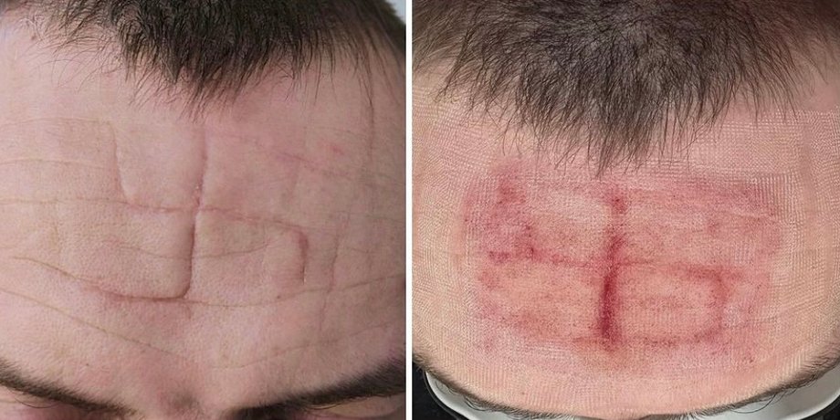 свастика это, нацистская свастика, что такое свастика, свастика это, пытки, пытки, русский плен