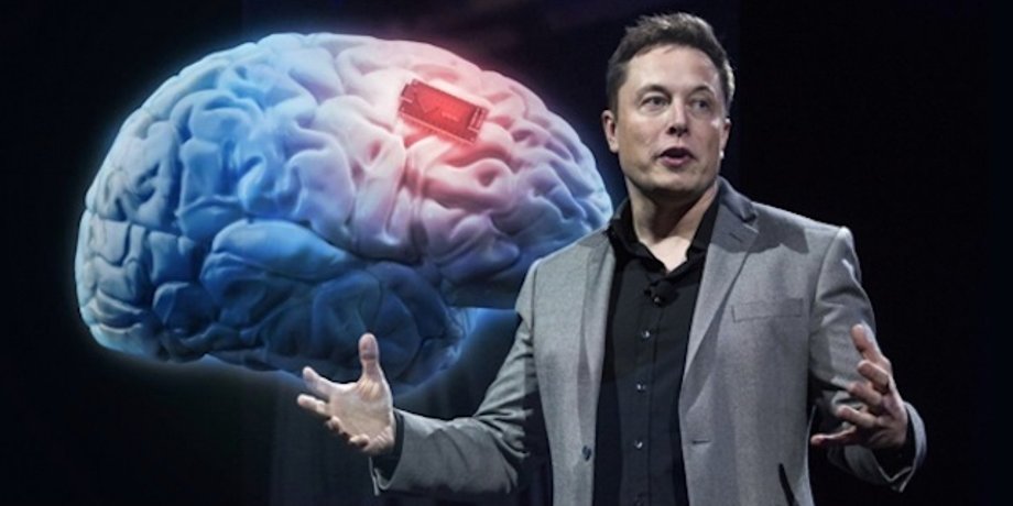 Neuralink