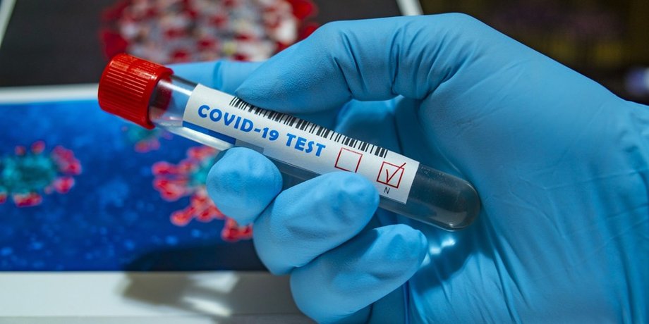 анализы на COVID-19