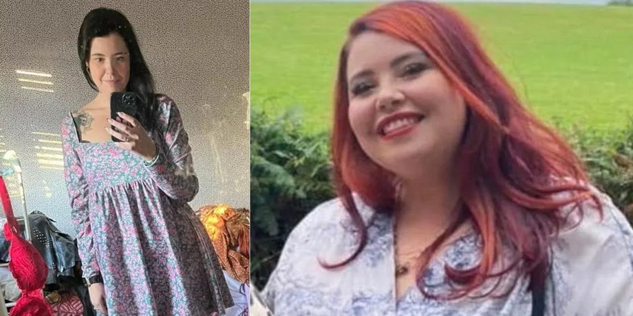 Женщина сбросила 63 кг благодаря TikTok, похудение, операция, лишний вес, сбросила лишний вес, объедалась шоколадом, попала в ловушку