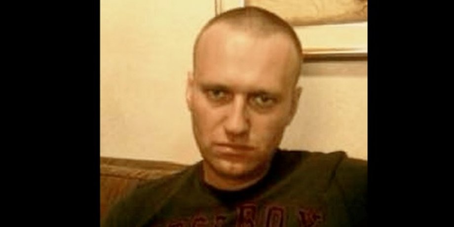 Россия, оппозиционер, алексей навальный, здоровье, навальный, колония