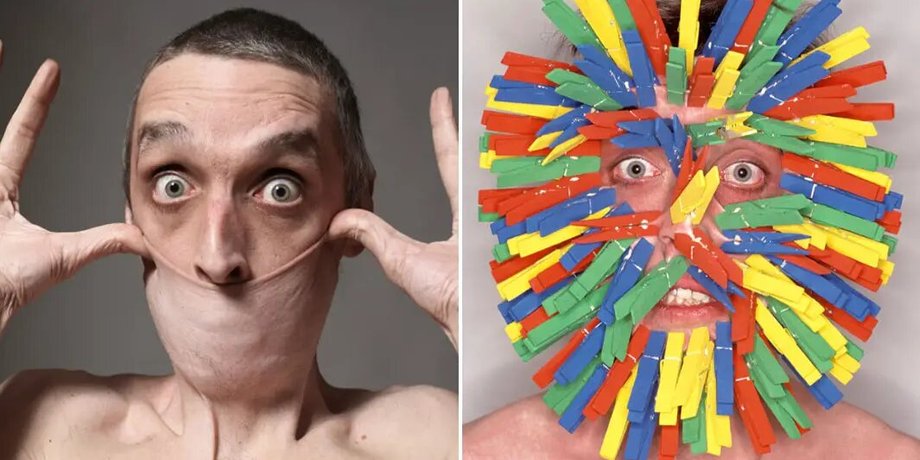 новости мира, гарри тернер, мужчина с самой эластичной кожей, книга рекордов гиннеса
