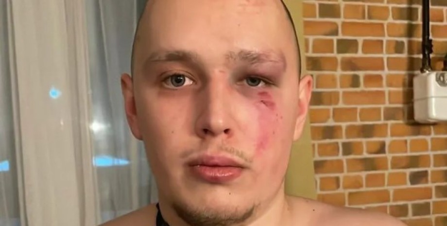 Ветеран ВСУ Алексей Иванин, избиение военного, ветеран больница, скандал в больнице, больница избиение человека