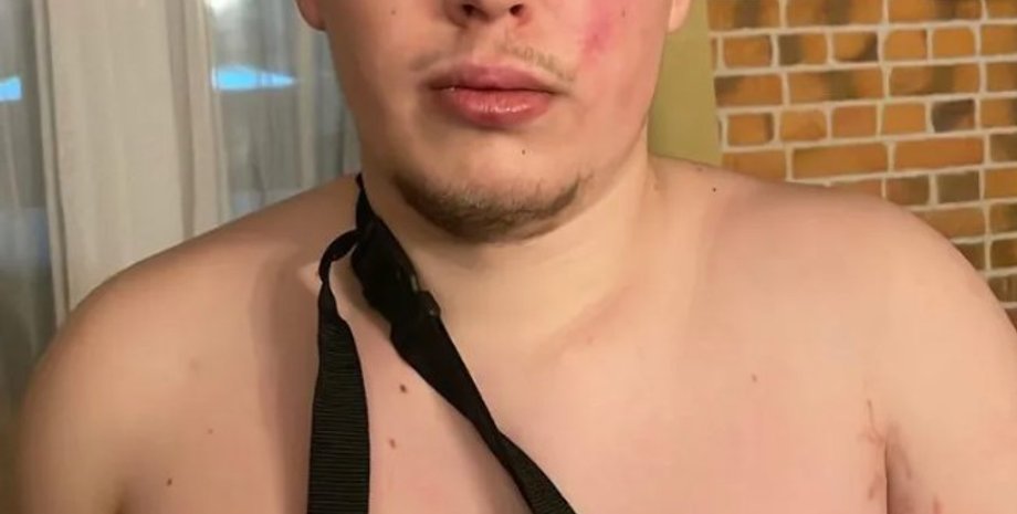 Ветеран ВСУ Алексей Иванин, избиение военного, ветеран больница, скандал в больнице, больница избиение человека