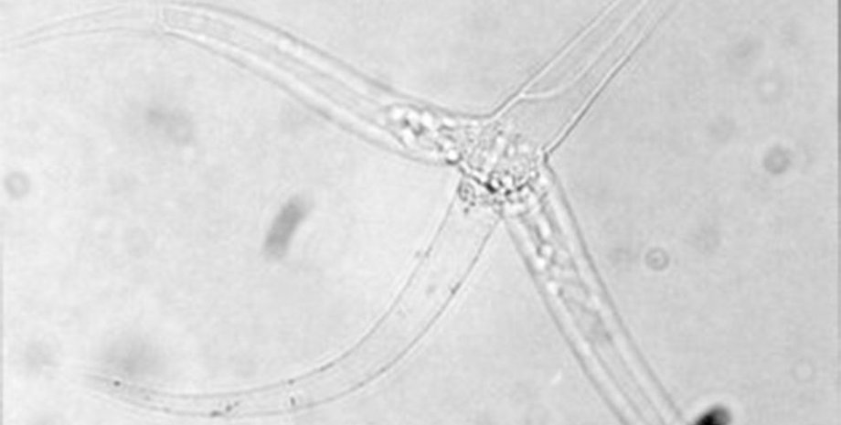 паразит Myxozoa