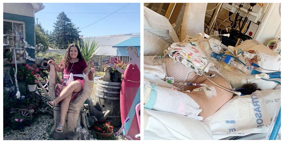 реанимация, ожоги, подросток, коллаж