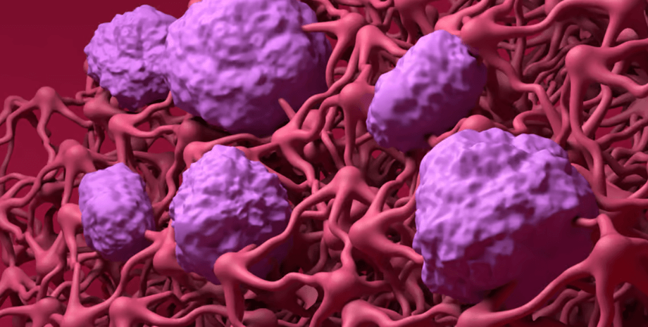 сетка сосудов, сосуды, кровеносные сосуды, амилоид, амилоидная бляшка