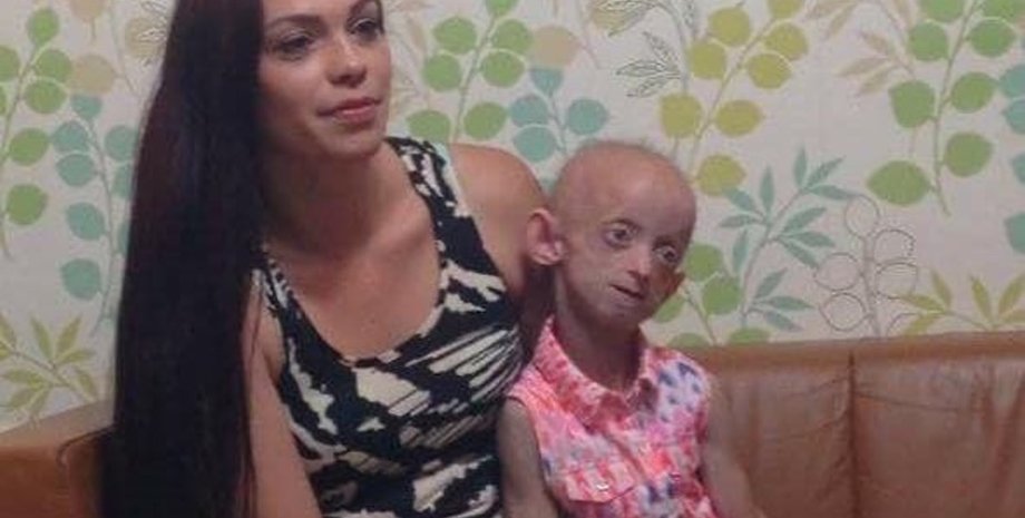 Ашанти Смит, прогерия