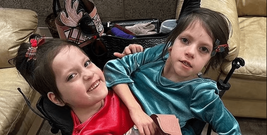 Биография сиамских близняшек Келли и Картер из США, уникальные дети, аномалии, операция, курьезы, удивительные истории, фото