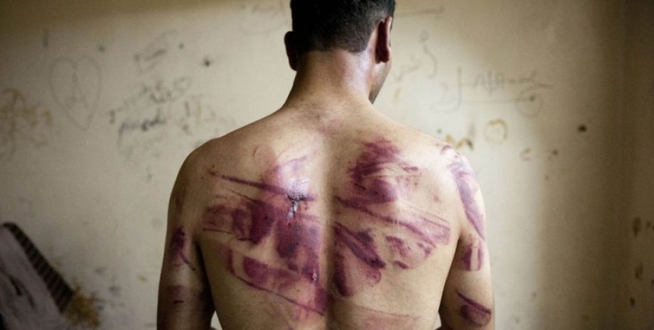 В Сирии жестоко пытают заключенных / Фото: AFP