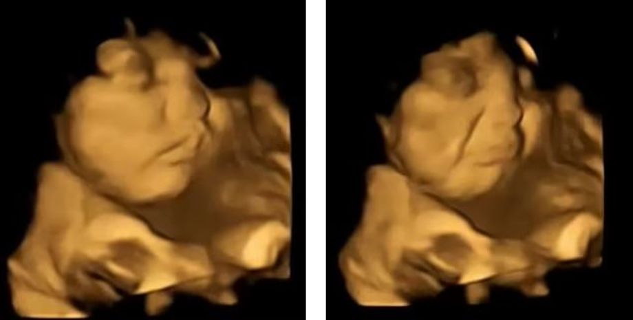 немовлята, діти кривляться