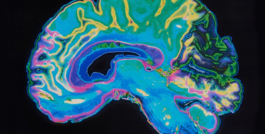 мозг, ЛСД, сознание