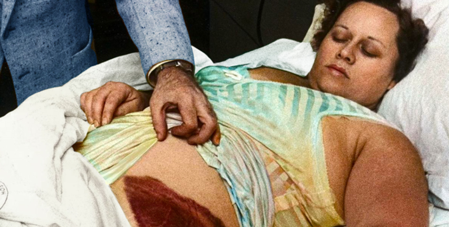 Метеорит впав на жінку, як це вплинуло на її життя та долю, Енн Годжес з містечка Сілакуга, США, курйози, цікаві історії