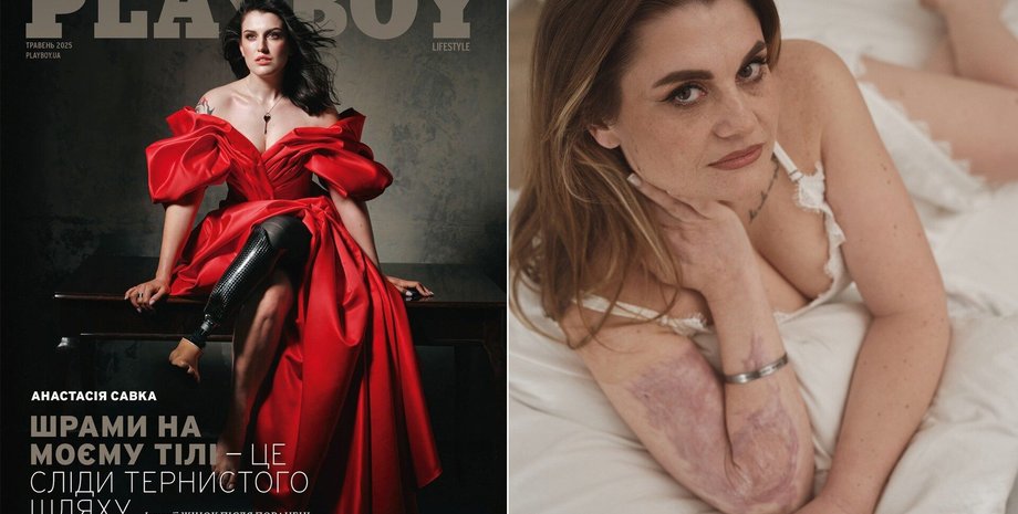 Українки зі шрамами війни у Playboy