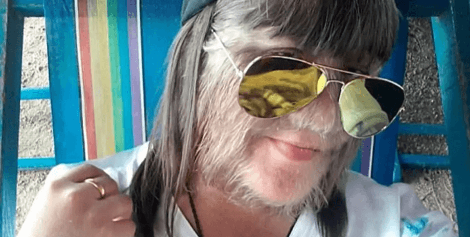 Самый волосатый подросток в мире, волосы на лице, Супатра Сасупхан, синдром оборотня, сменила образ, рекорд, Книга Гиннесса, синдром Амбраса