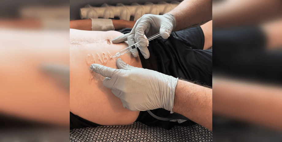 После обмена пленными военному удаляют шрам после обмена пленными