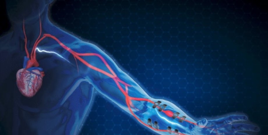 графеновый сенсор, графеновый датчик