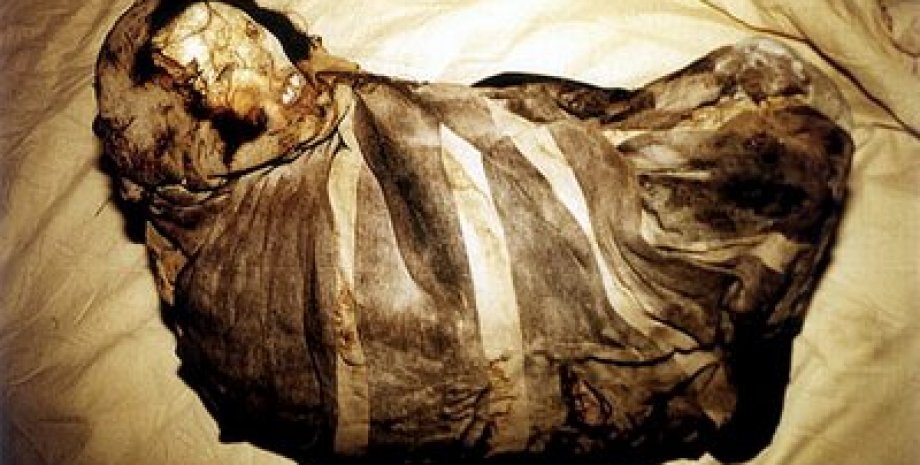 Мумифицированная женщина, Кокцидиоидоидомикоз, грибковая инфекция, боливийская мумия, древние болезни, поражение скелета, андские мумии, историческая патология, доиспанская Южная Америка