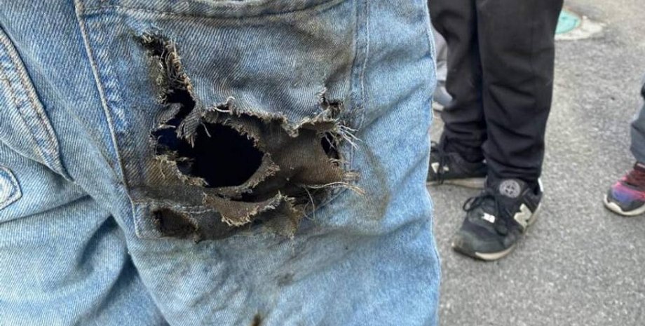 подросток шахед ожоги, взорвалась деталь шахеда