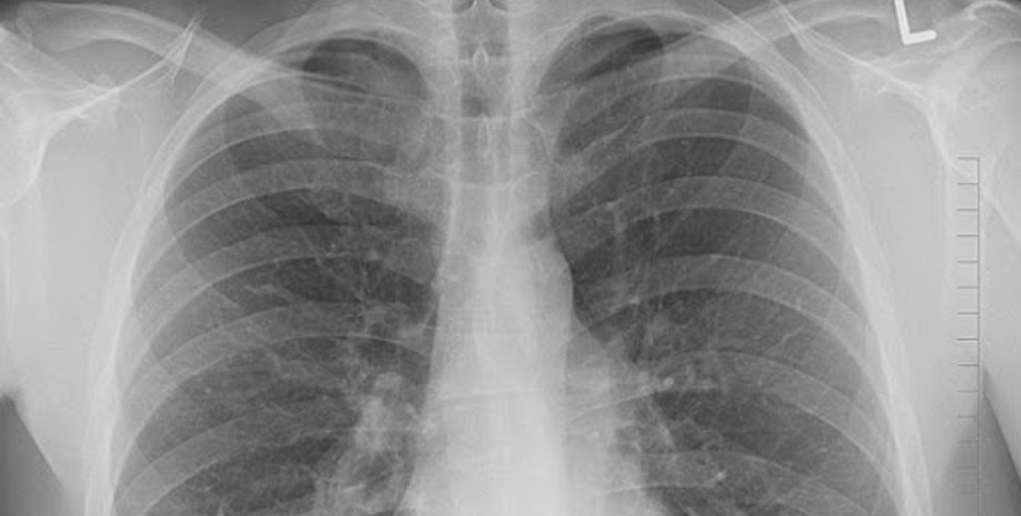 Фото: workingmama