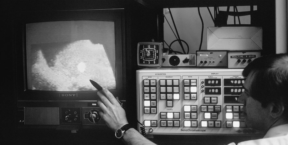 узи, аппарат узи, ультразвуковое исследование