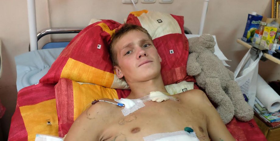 Александр Чекменев, Фокус