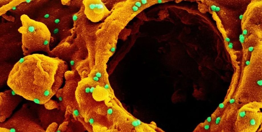 коронавирус, британский штамм, COVID-19