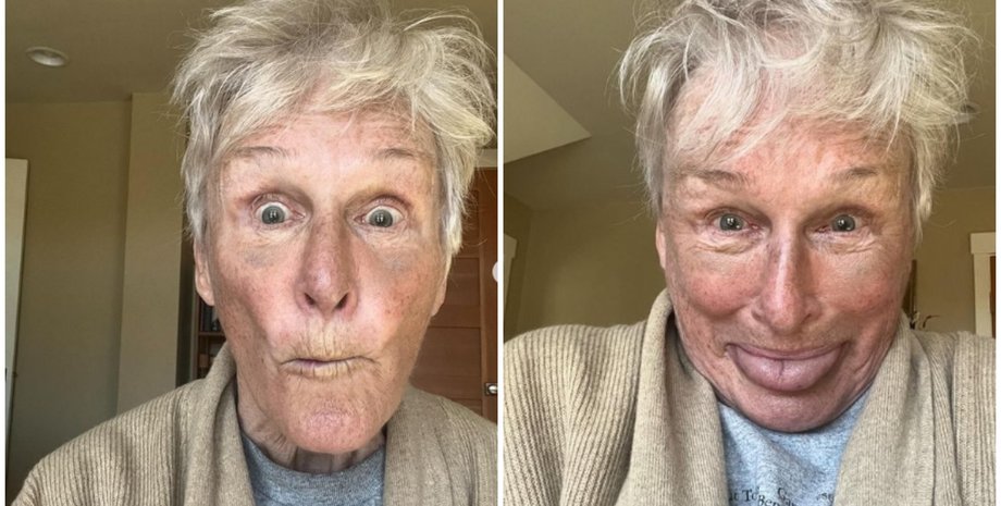 Гленн Клоуз