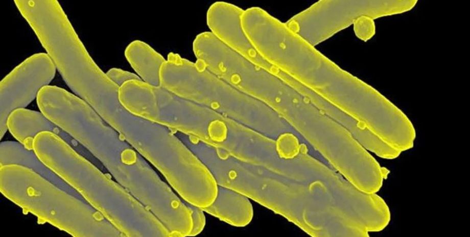 легочные инфекции