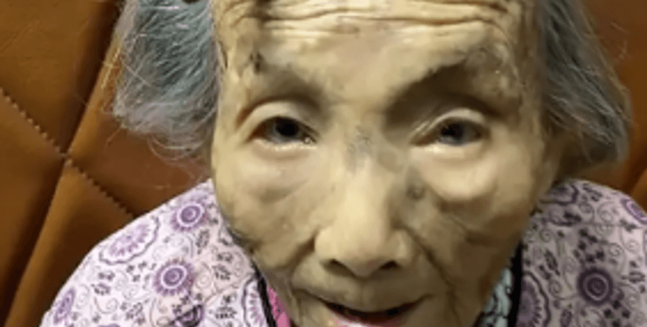 107 річна Чен з рогом на лобі