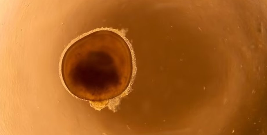 мини-глаза, мини-сетчатка