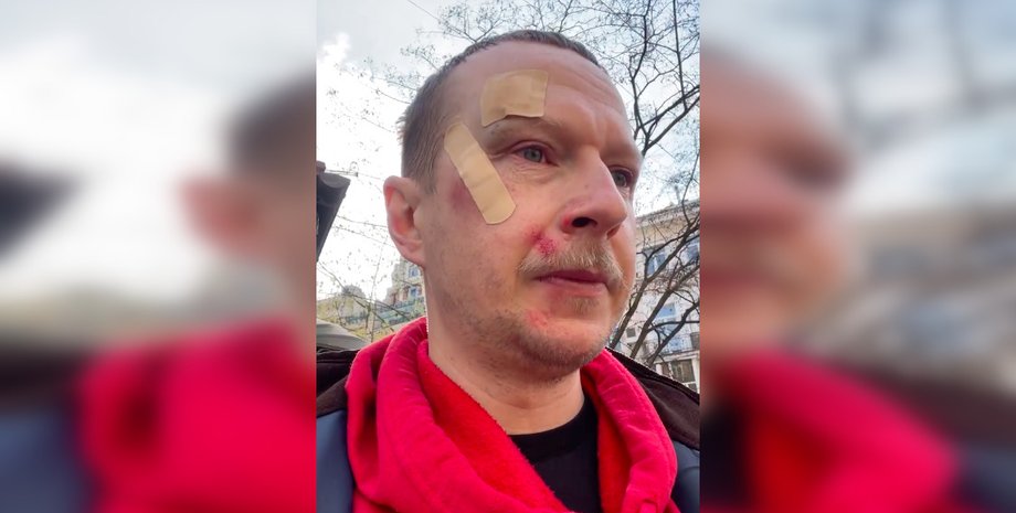 Майкл Щур, Роман Винтонив, избиение, самокаты, судебно-медицинская экспертиза