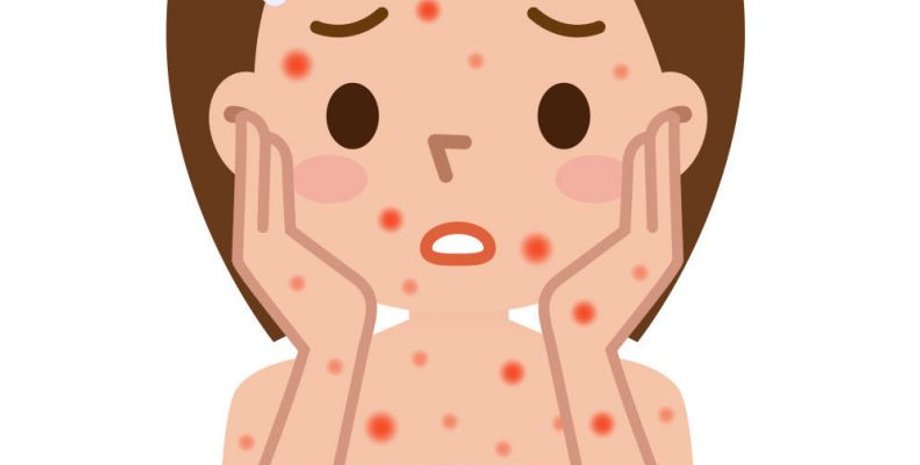 Иллюстрация: tsn.ua