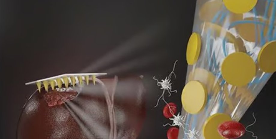 кров, мікроголки