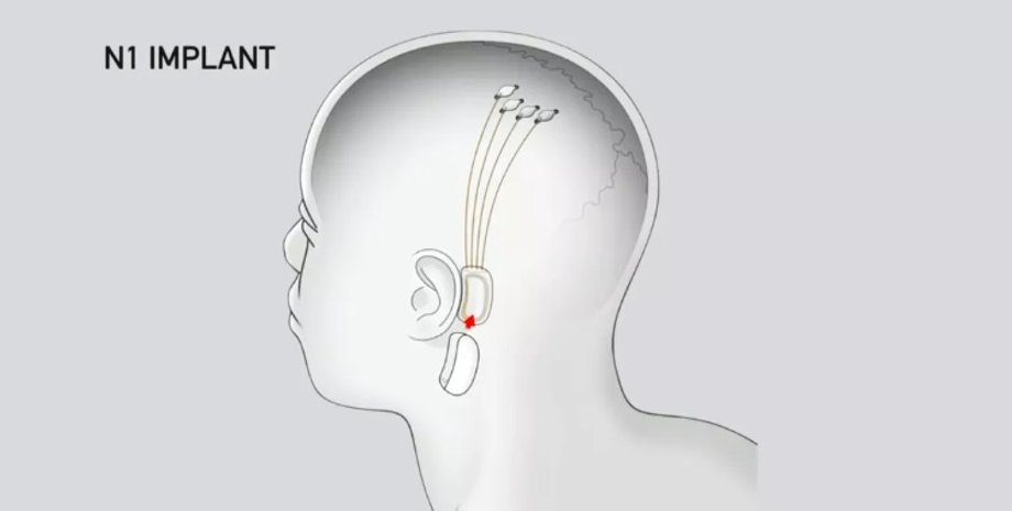 Фото: Neuralink; Screenshot by Stephen Shankland/CNET