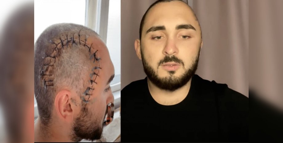 избиение, Киев, блогер