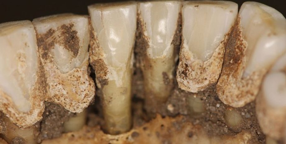 зубы, древние люди, наркотики