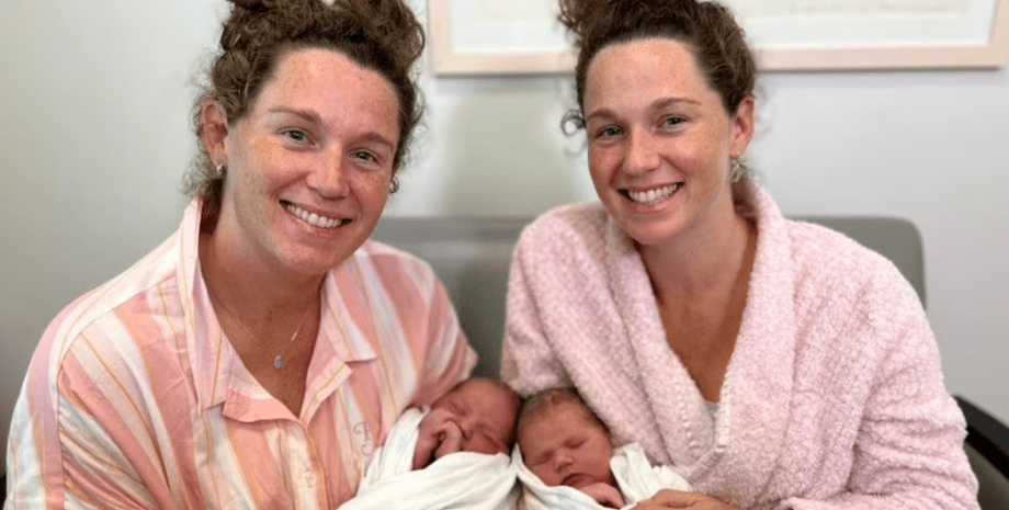 Однояйцевые близнецы, роды, рождение детей, аномалии, Австралия, курьезы, фото