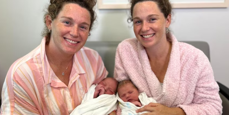 Однояйцеві близнюки, пологи, народження дітей, аномалії, Австралія, курйози, фото