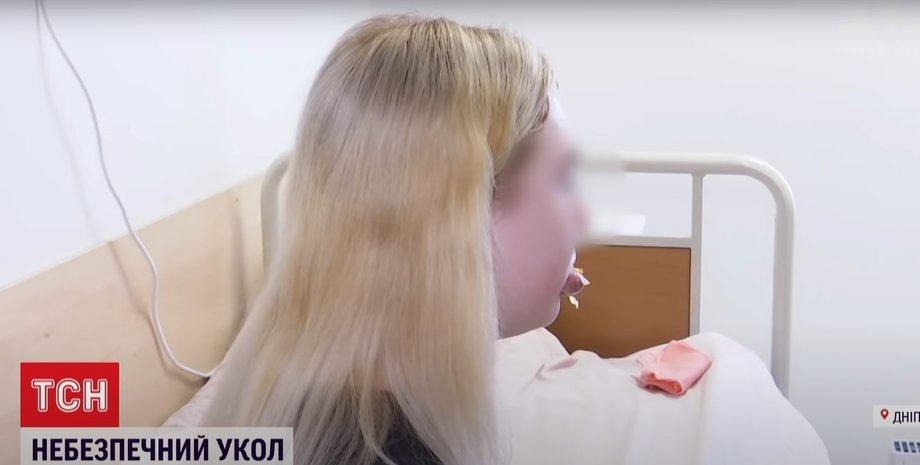 Укол у губи