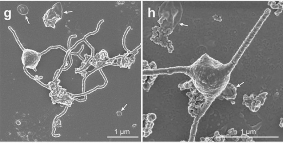 Фото: Prometheoarchaeum syntrophicum. Фото: Imachi et al., bioRxiv