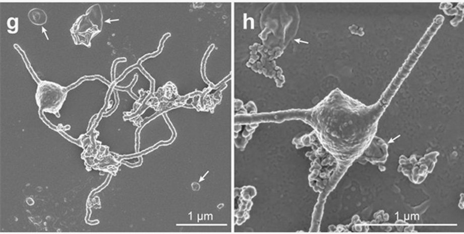 Фото: Prometheoarchaeum syntrophicum. Фото: Imachi et al., bioRxiv