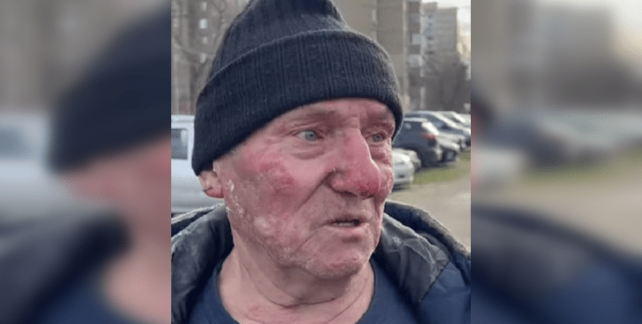 Василий Андреевич, отогнал микроавтобус, отогнал машину, горящий микроавтобус