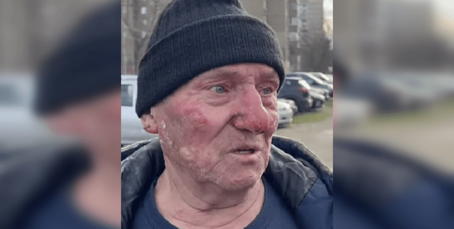 Василь Андрійович, відігнав мікроавтобус, відігнав машину, палаючий мікроавтобус